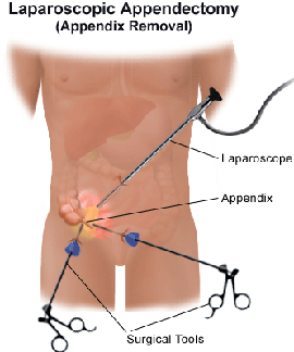 appendix