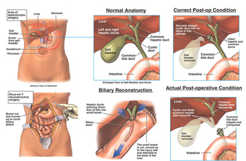 gallbladder